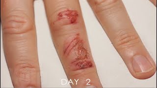 Timelapse Of A Wound Healing