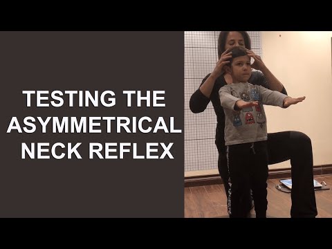 Asymmetrical Tonic Neck Reflex  - Clinical Examination