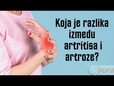 artroza a 1 2 etapă a articulației șoldului inflamația măduvei articulare