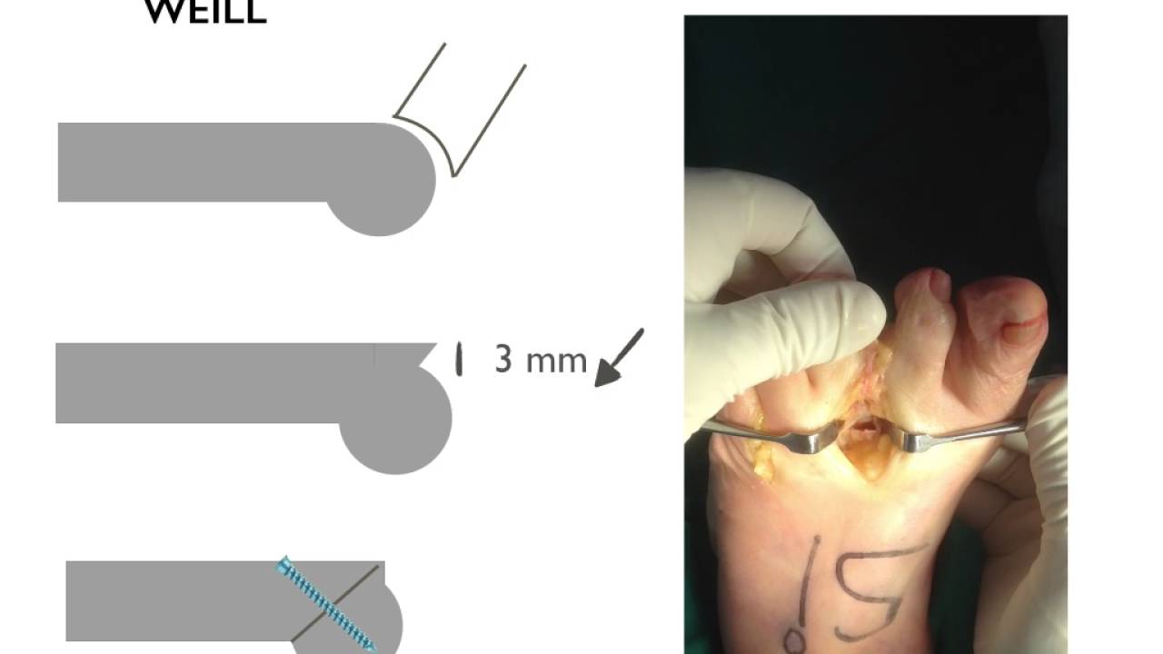 Gustavo Adolfo Bacca Insuasty-6