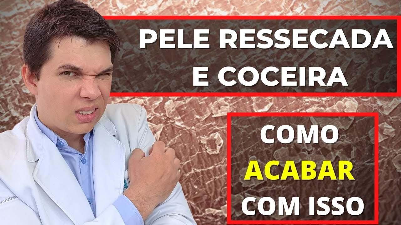COCEIRA E PELE RESSECADA: Como acabar com isso! DICAS PARA PELE SECA