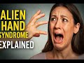 Alien Hand Syndrome EXPLAINED The Scariest Neurological Disorder You Ve NEVER Heard Of