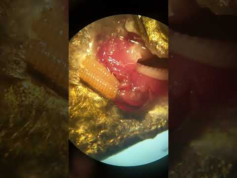 Video of a copepod in the family Pennellidae, Haemobaphes dicaeraus, from gills of kinki rockfish (Sebastolobus alascanus), courtesy of Matt Wilson