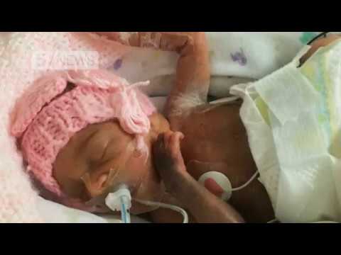 One-pound ‘miracle baby’ survives being born four months premature | 5 News