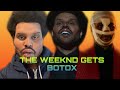 THE WEEKND GETS BOTOX AND THE INTERNET GOES GRAZY