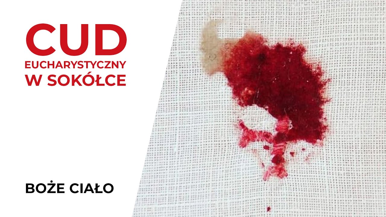 Cud Eucharystyczny w Sokółce oczami naukowców badający to zjawisko | BOŻE CIAŁO