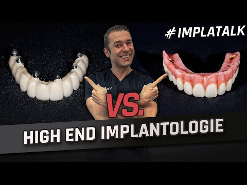 All-on-6 vs. removable bridge as premium care in the edentulous jaw