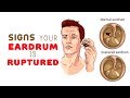 8 Signs Your Eardrum is Ruptured