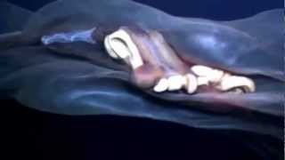 Jelly Fish Hipnotica