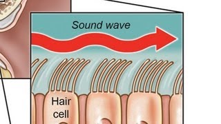 3 Different Types of Hearing Loss | Ear Problems