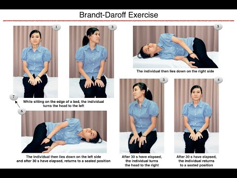 Brandt-Daroff Exercise - Home Therapy for BPPV