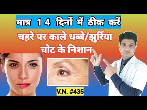 Eukroma Skin Lightening Cream