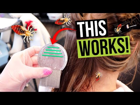 Lice Combing Techniques - How to Comb Lice out of Your Hair