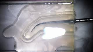 Efficient bypassing technique with a special setting of an Ai motor with T mode, Aiモーターを使ってのバイパス形成法