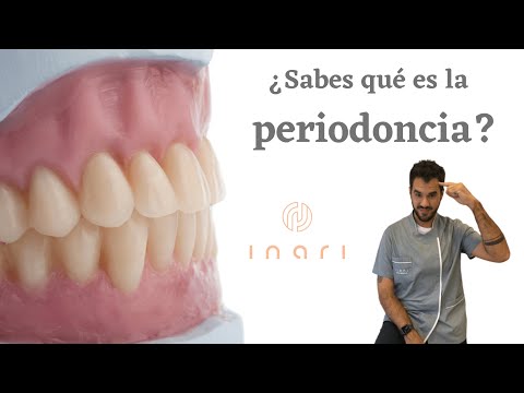 Tratamiento de periodoncia