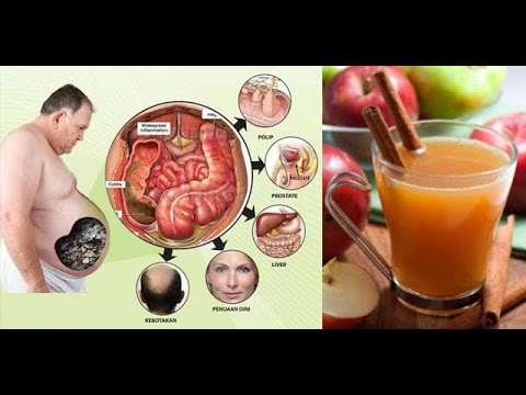 Biaya melangsingkan Cina dengan handuk Yang mungkin meresepkan endokrinologi untuk menurunkan berat badan