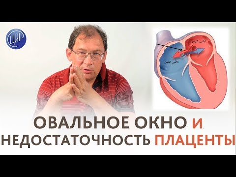 Функционирующее ОВАЛЬНОЕ ОКНО и фетоплацентарная недостаточность.