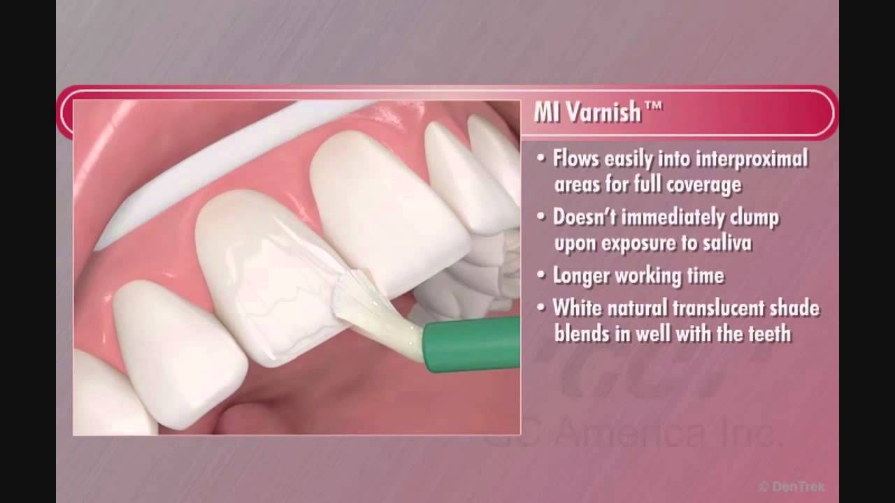 Présentation MI Varnish (Anglais)