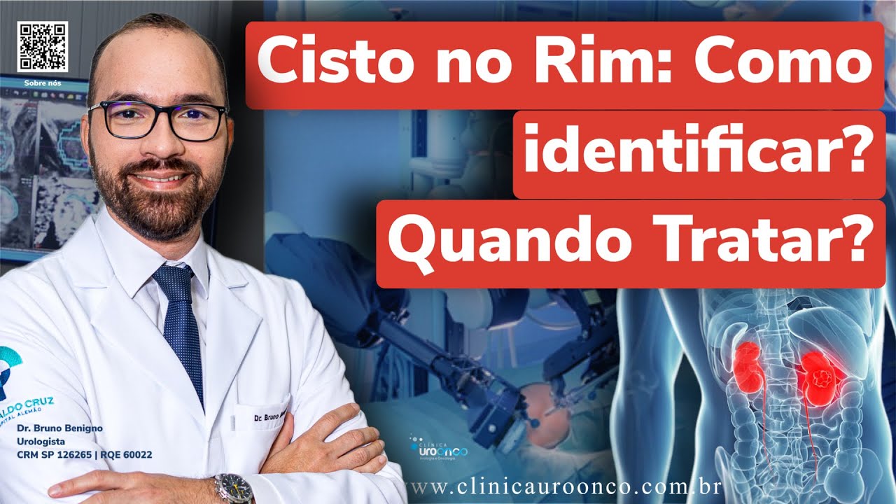 Cisto no Rim: Um Perigo Silencioso. Como detectar e Tratar?