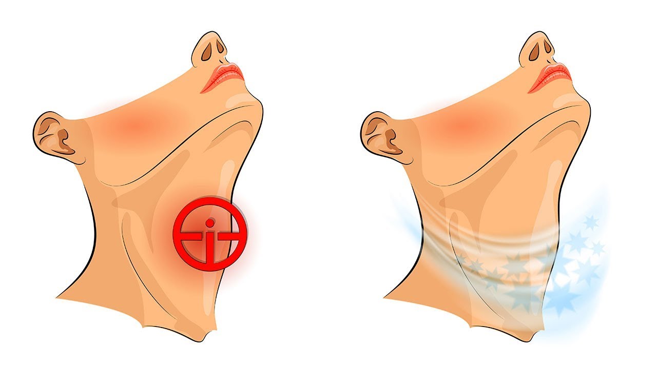 4 Tipps, wie du Halsschmerzen schnell los wirst!