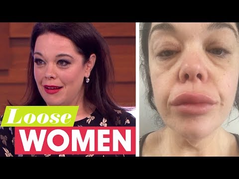 Lisa Riley Denies Having Lips Fillers and Explains Her Swollen Appearance | Loose Women
