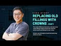 [MacArthur Park Dentistry] Case Study: Replacing Old Fillings with Crowns -Part 1-