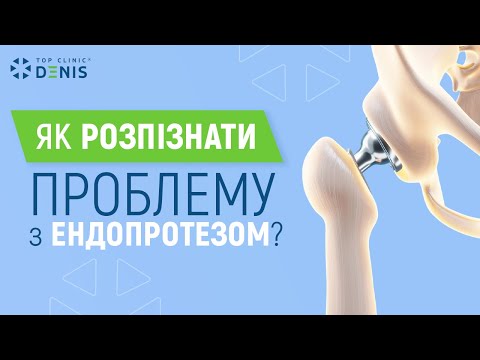 Как вовремя распознать проблему с эндопротезом? - TOP Clinic DENIS