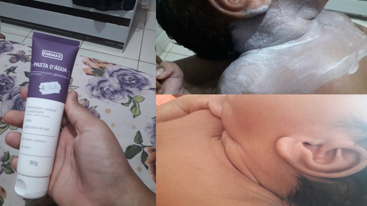 RESENHA DA PASTA D'AGUA COM GLICERINA PARA BROTOEIJAS E ASSADURAS