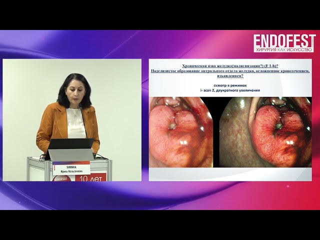 Секция Амбулаторная эндоскопия ЭндоФест 2023
