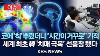 [이슈] 코에 '칙' 뿌리면 기적이 "시간이 거꾸로"...세계 최초 韓 '치매 극복' 선봉장 섰다/2026년 7월 27일(월)/KBS
