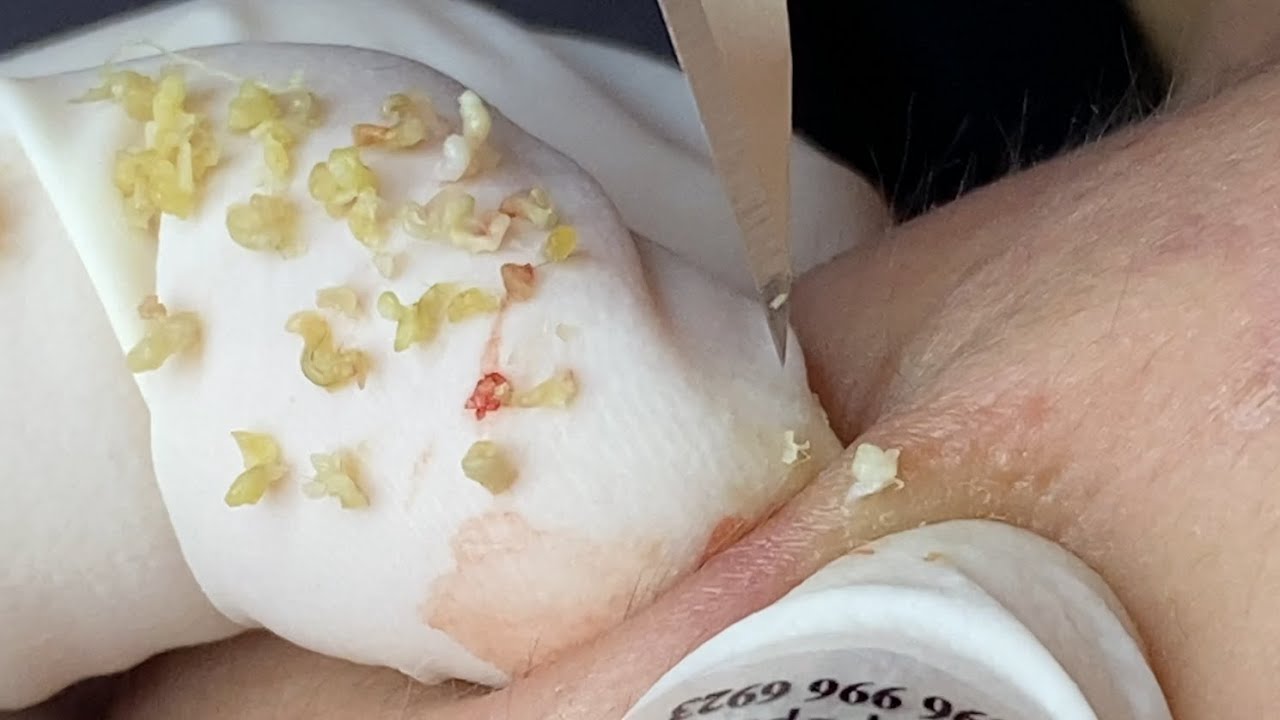 YouTube Thumbnail Downloader FULL HQ IMAGE