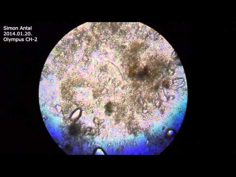 Microscope #1 - Olympus CH-2 - Simon Antal - 2014.01.20.