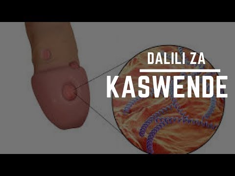 , title : 'kaswende na Dalili Zake - Kaswende #1'