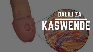 kaswende na Dalili Zake - Kaswende #1