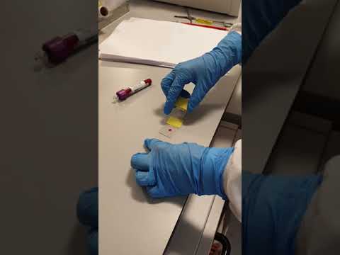 Haematology, South West Acute Hospital | Biomedical Science at the Western Trust