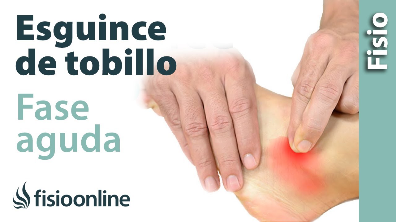 Esguince de tobillo grado 2-3 (moderado-grave) - Tratamiento en fase aguda o reciente
