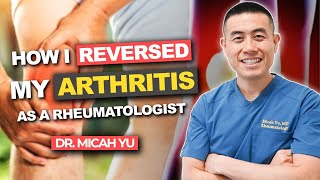 How I REVERSED my ARTHRITIS NATURALLY as a Rheumatologist | Dr. Micah Yu