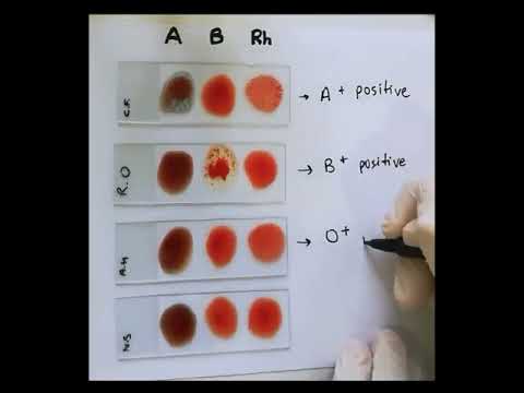 Qan qruplarının təyini