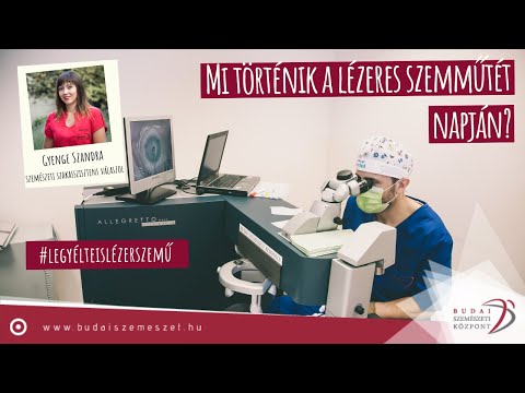 emberi látásküszöb lövész nézete
