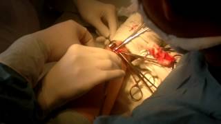 preview picture of video 'Surgery in hand 1'