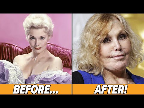 Celebrities Who Destroyed Their Looks with Plastic Surgery