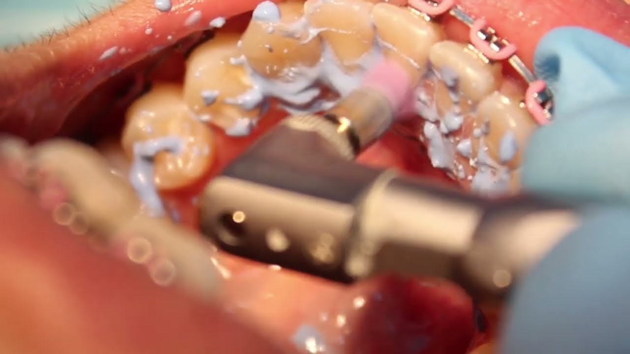 Ricardo Poblete Quezada-5