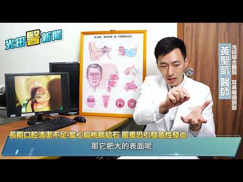 影片縮圖