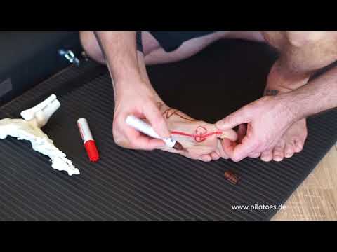 Das PilaToes Erklärvideo zum Hallux Valgus