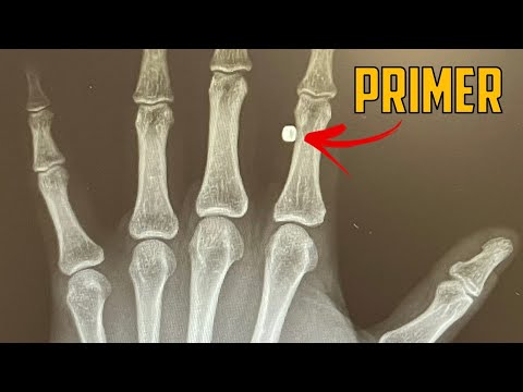 Die dümmsten Dinge, die ich mit Waffen gemacht habe