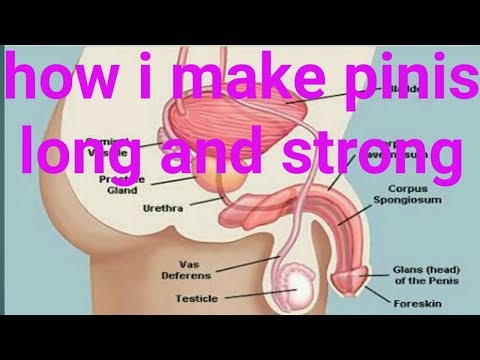 download lagu mp3 mp4 Pinis, download lagu Pinis gratis, unduh video klip Pinis