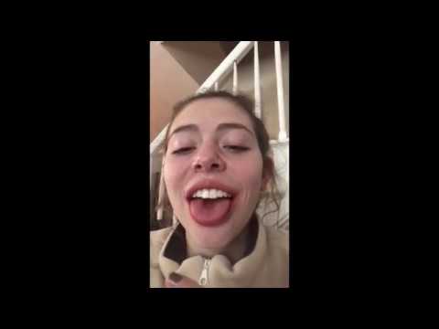 Wisdom Teeth Masco Frolics 2018