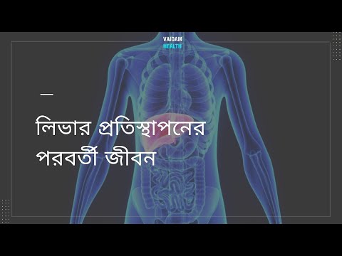 লিভার প্রতিস্থাপনের পরবর্তী জীবন