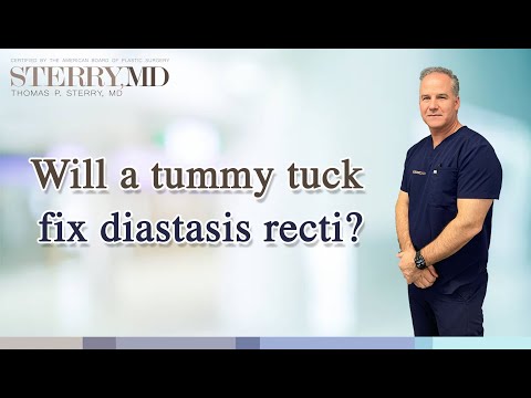 Can a Tummy Tuck Fix Diastasis Recti? I NYC Plastic Surgeon Dr. Thomas P. Sterry