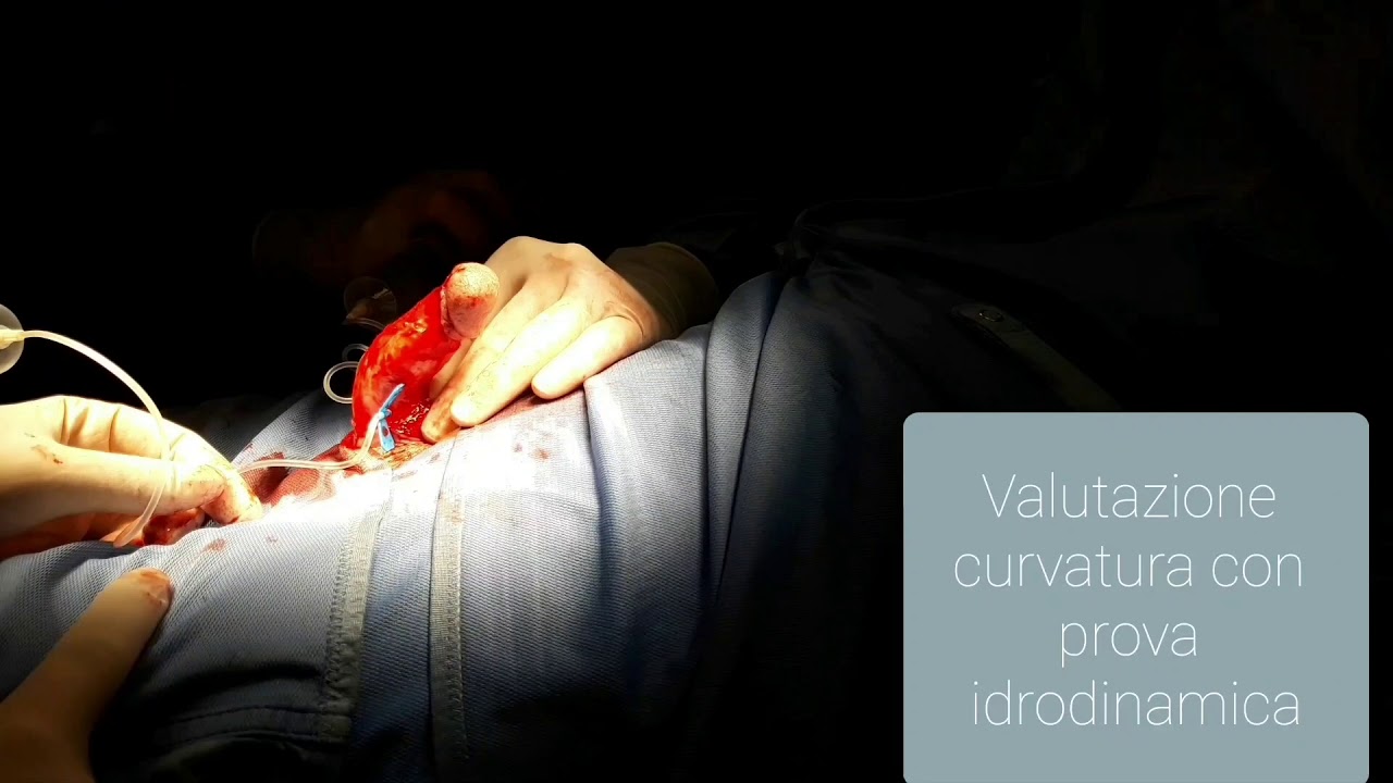 Pier Andrea Della Camera-87